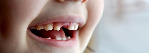 Tandplejetilbud til børn og unge